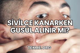 Sivilce Kanarken Gusül Alınır Mı?