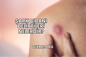 Şark Çıbanı Belirtileri Nelerdir?