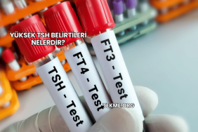 Yüksek TSH Belirtileri Nelerdir?