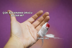 Çok Az Kanama Orucu Bozar mı?