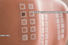 Deri Testi Orucu Bozar mı?