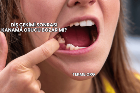 Diş Çekimi Sonrası Kanama Orucu Bozar mı?