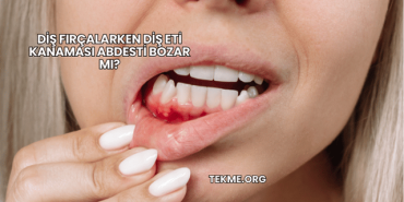 Diş Fırçalarken Diş Eti Kanaması Abdesti Bozar mı?
