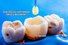Dişe Dolgu Yaptırmak Orucu Bozar mı?