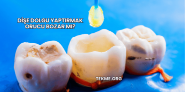 Dişe Dolgu Yaptırmak Orucu Bozar mı?