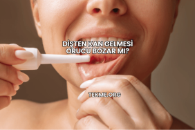 Dişten Kan Gelmesi Orucu Bozar mı?