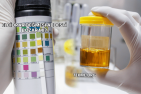 Ele İdrar Değmesi Abdesti Bozar mı?