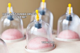 Hacamat Olmak Orucu Bozar mı?