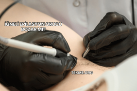 İğneli Epilasyon Orucu Bozar mı?