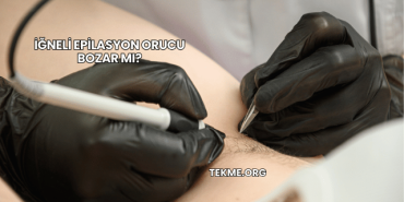 İğneli Epilasyon Orucu Bozar mı?