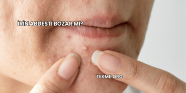 İrin Abdesti Bozar mı?