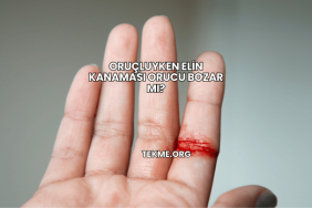 Oruçluyken Elin Kanaması Orucu Bozar mı?