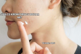 Sivilce Kremi Orucu Bozar mı?
