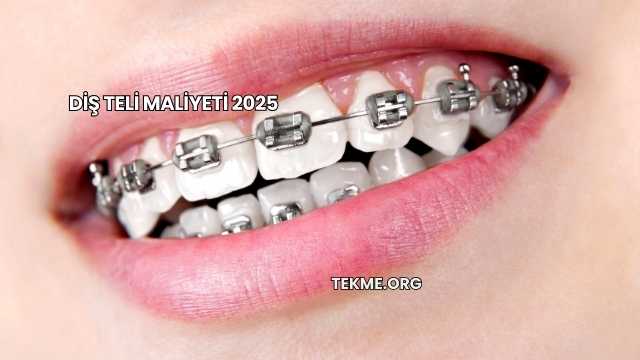 Diş Teli Maliyeti 2025