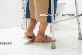 Kiraz Sapı Ödem Attırır mı?