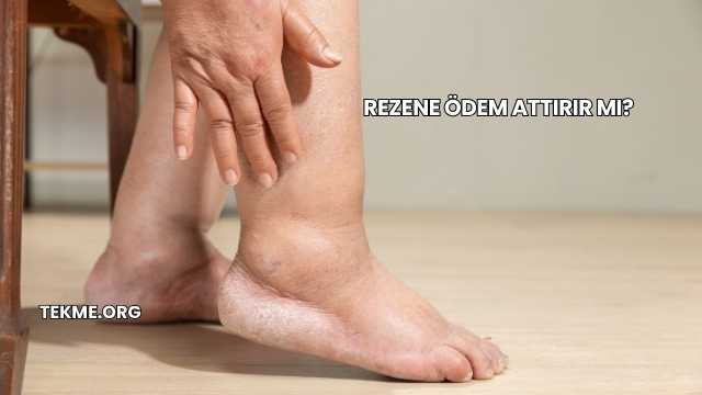 Rezene Ödem Attırır mı?