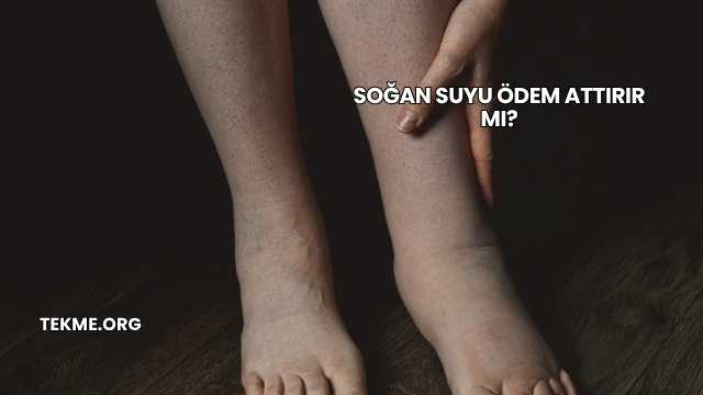 Soğan Suyu Ödem Attırır mı?