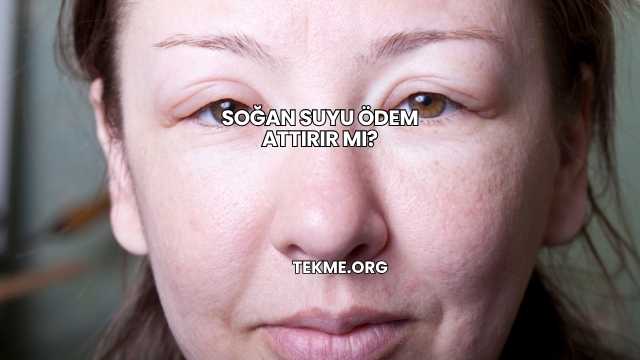 Soğan Suyu Ödem Attırır mı?