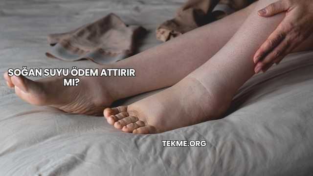 Soğan Suyu Ödem Attırır mı?