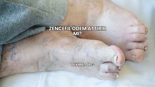 Zencefil Ödem Attırır mı?