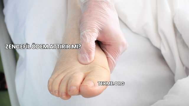 Zencefil Ödem Attırır mı?