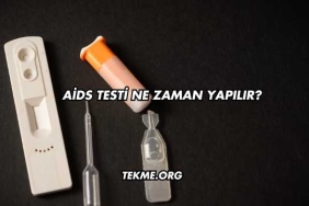 Aids Testi Ne Zaman Yapılır?