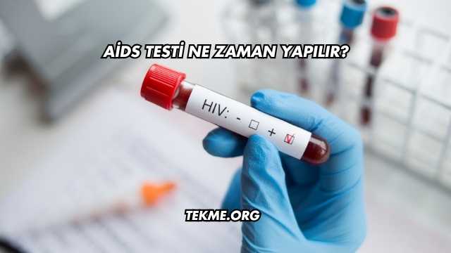 Aids Testi Ne Zaman Yapılır?