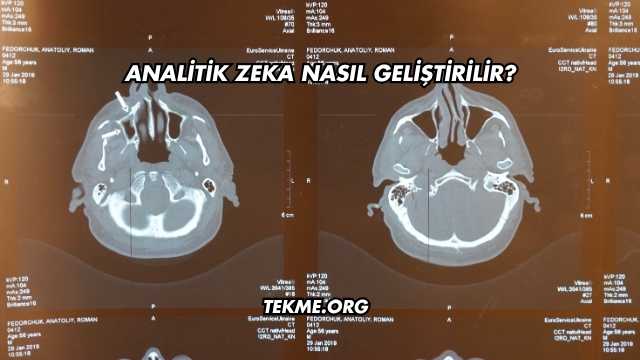 Analitik Zeka Nasıl Geliştirilir?