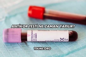 Antikor Testi Ne Zaman Yapılır?