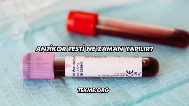 Antikor Testi Ne Zaman Yapılır?