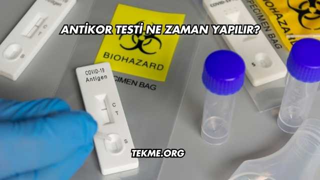 Antikor Testi Ne Zaman Yapılır?