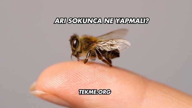 Arı Sokunca Ne Yapmalı?