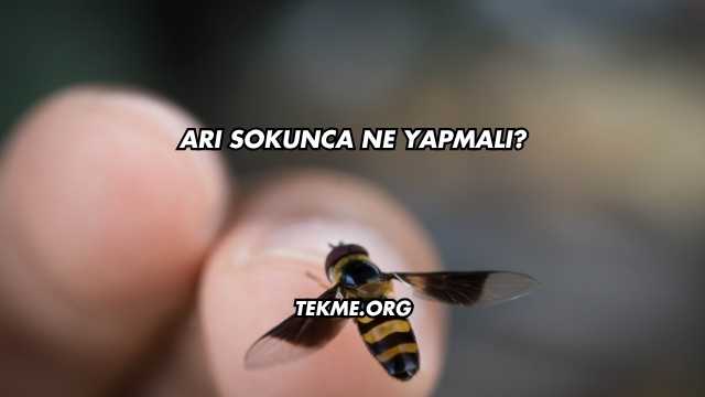 Arı Sokunca Ne Yapmalı?
