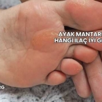 Ayak Mantarına Hangi İlaç İyi Gelir?
