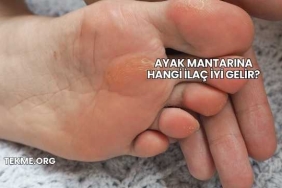 Ayak Mantarına Hangi İlaç İyi Gelir?