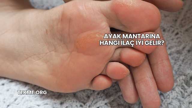 Ayak Mantarına Hangi İlaç İyi Gelir?