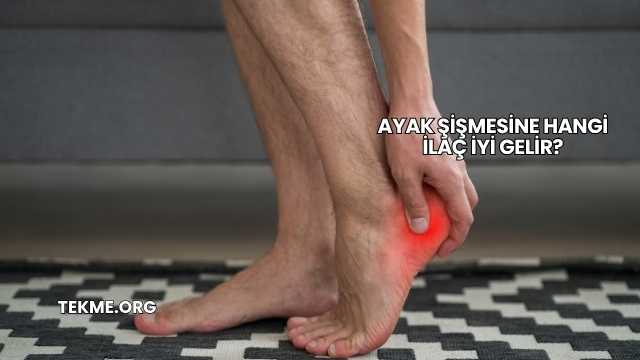 Ayak Şişmesine Hangi İlaç İyi Gelir?