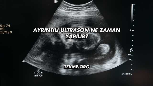 Ayrıntılı Ultrason Ne Zaman Yapılır?