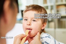 Bademcik Şişmesine Hangi İlaç İyi Gelir?
