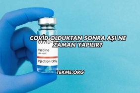 Covid Olduktan Sonra Aşı Ne Zaman Yapılır?