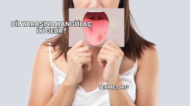 Dil Yarasına Hangi İlaç İyi Gelir?