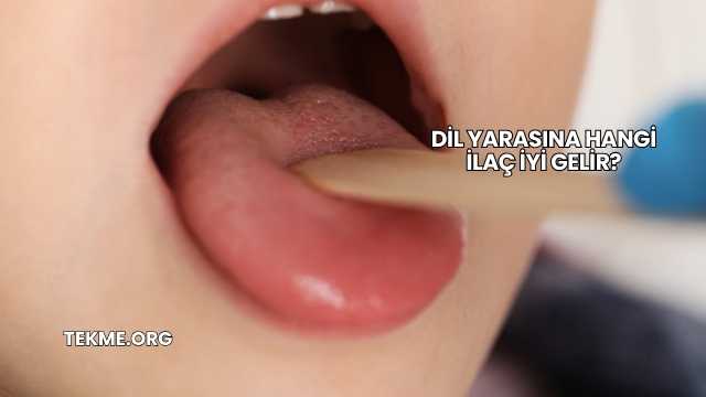 Dil Yarasına Hangi İlaç İyi Gelir?