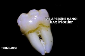 Diş Apsesine Hangi İlaç İyi Gelir?