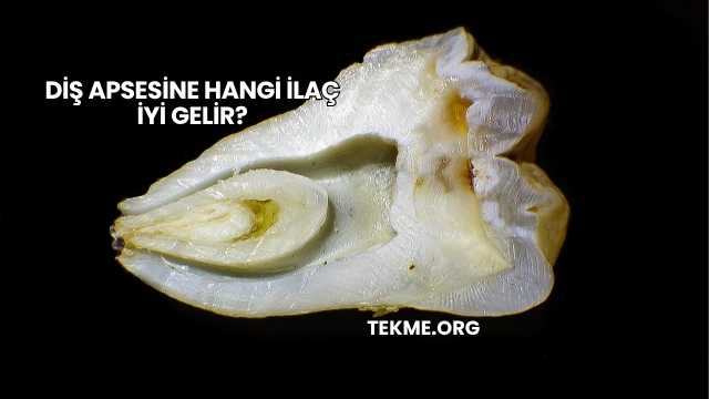 Diş Apsesine Hangi İlaç İyi Gelir?