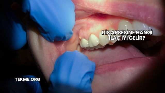 Diş Apsesine Hangi İlaç İyi Gelir?