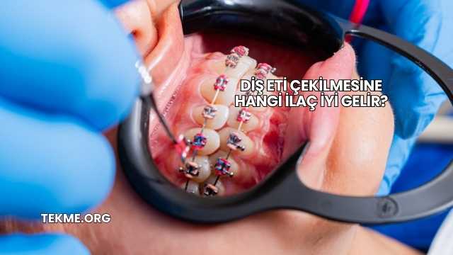 Diş Eti Çekilmesine Hangi İlaç İyi Gelir?