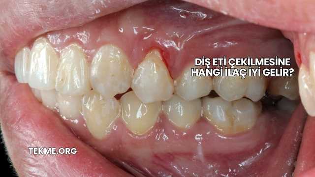 Diş Eti Çekilmesine Hangi İlaç İyi Gelir?