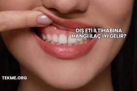 Diş Eti İltihabına Hangi İlaç İyi Gelir?