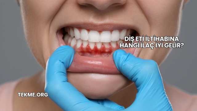 Diş Eti İltihabına Hangi İlaç İyi Gelir?