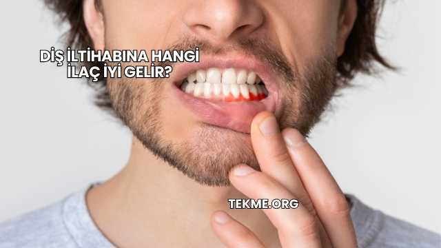 Diş İltihabına Hangi İlaç İyi Gelir?